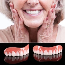 Great Smile Veneer (Upper & Lower)