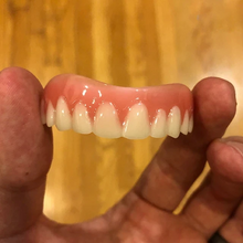 Great Smile Veneer (Upper & Lower)