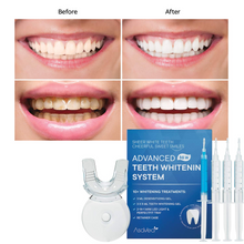 Premium Teeth Whitening Kit, LED Light, At-Home System Without Pain or Sensitivity, Effectively Removes Stains for Whiter Teeth