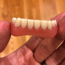 Great Smile Veneer (Upper & Lower)