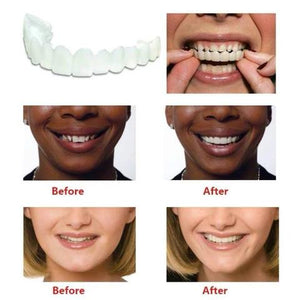 INSTANT SMILE VENEER - Upper & Lower Included