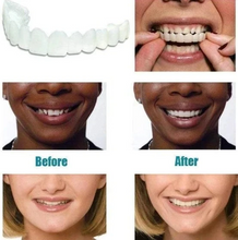 50%OFF !!!🔥Hot Sale🔥MAGIC Teeth Brace