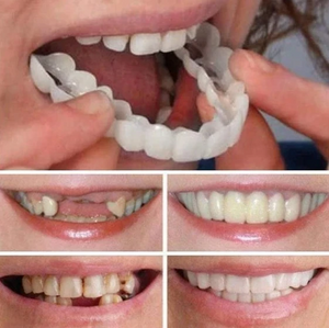 50%OFF !!!🔥Hot Sale🔥MAGIC Teeth Brace